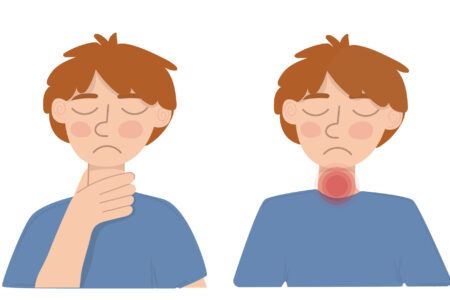 喉の腫れ感とは、喉に違和感、飲み込みにくさ、または喉の締め付け感などの症状が伴う状態を指します。