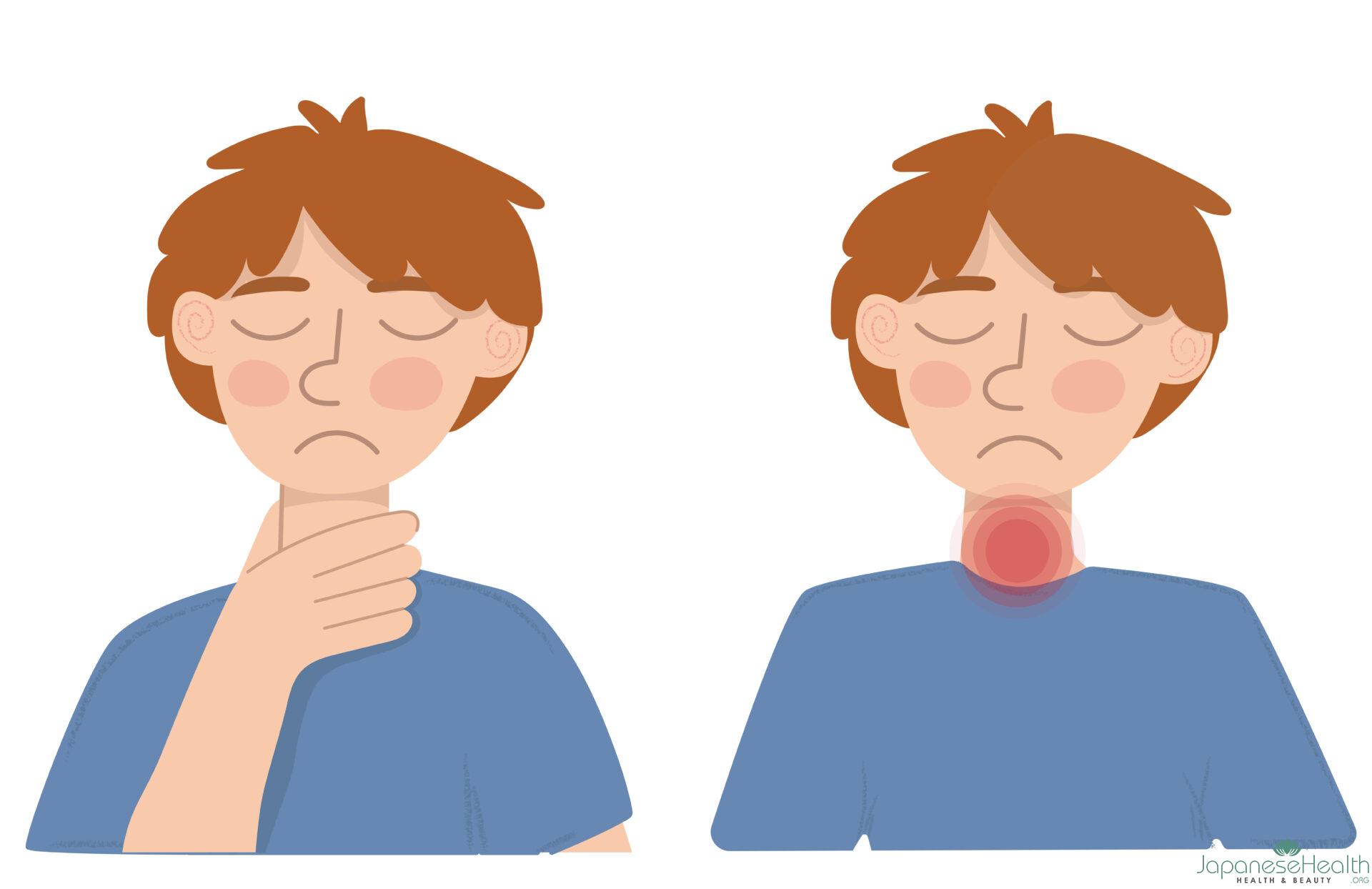 喉の腫れ感とは、喉に違和感、飲み込みにくさ、または喉の締め付け感などの症状が伴う状態を指します。