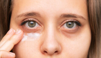 目の周りやまぶたの皮膚は、他の部位に比べて薄いのが特徴です。