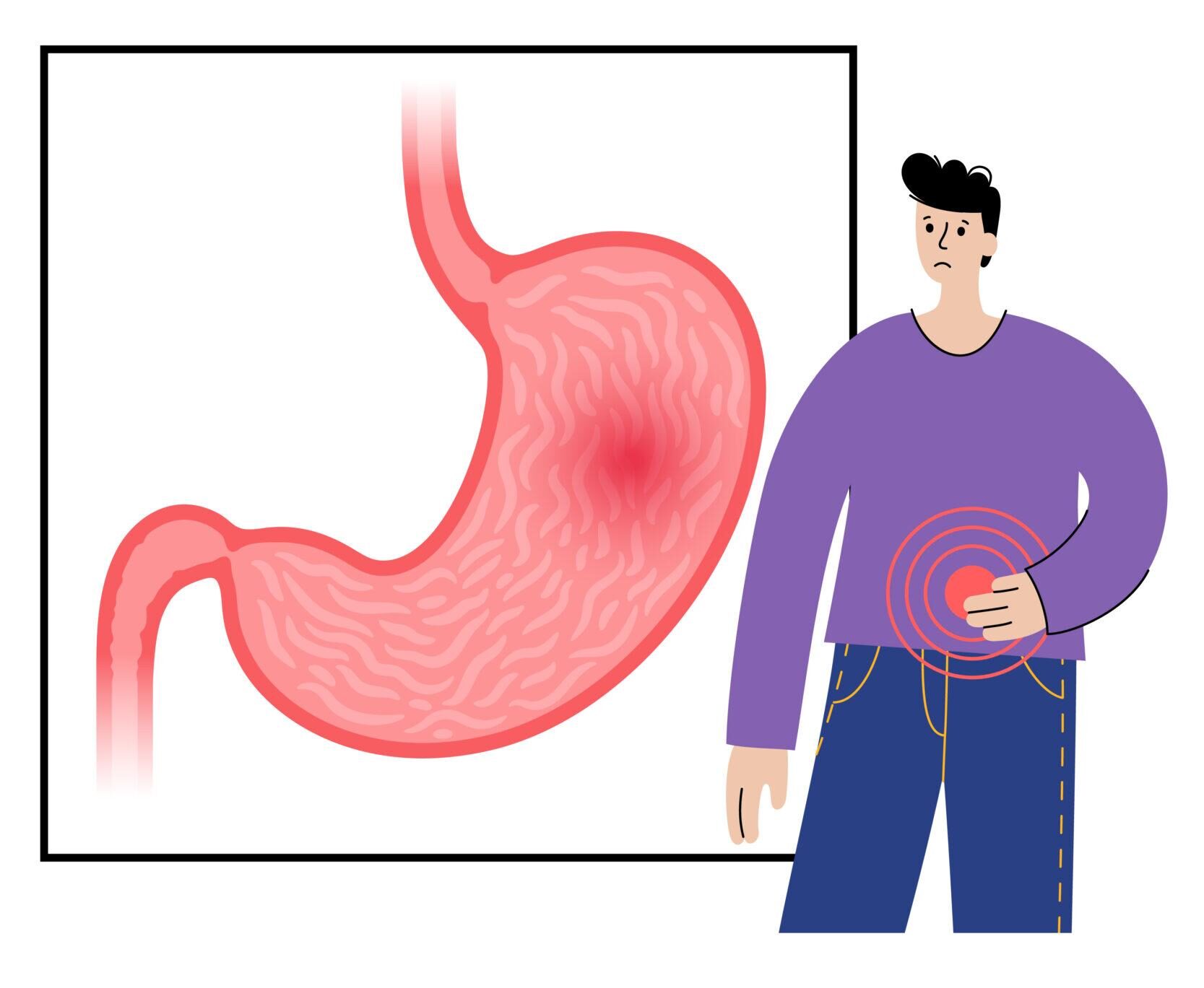 上腹部の痛み: 胃の領域に感じる鈍痛や焼けるような痛み。