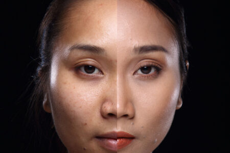 顔の左右非対称をどう解決する？美容と健康への影響
