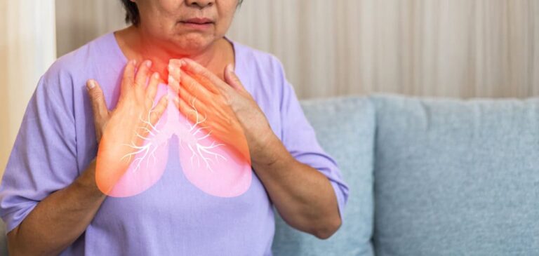 【専門家が解説】肺がんの早期発見｜自宅での症状チェック、検査キットの比較、最新の公的検診（CT・X線）まで