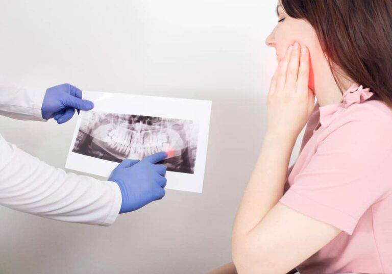 親知らず抜歯後の痛みはいつまで？ピーク、食事、ドライソケット対策の完全ガイド