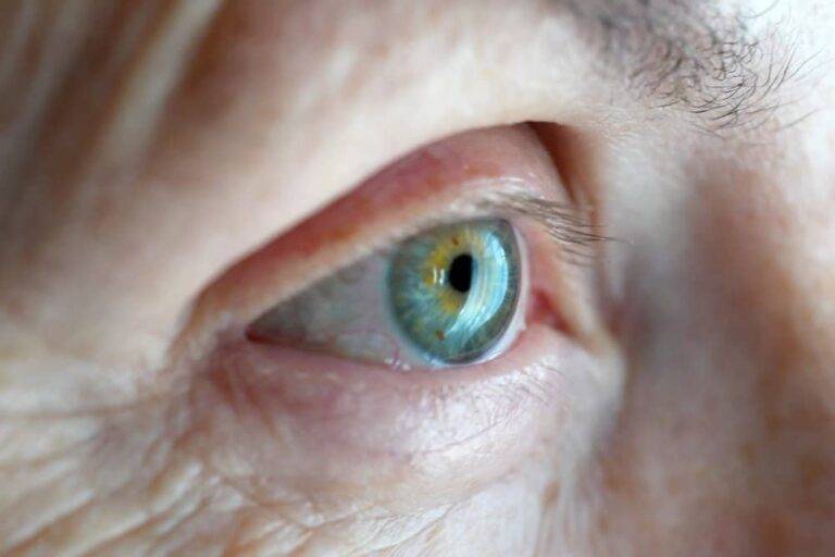 眼瞼下垂のすべて：原因、危険な自己治療、最新の治療法（手術・新薬）と費用を徹底解説