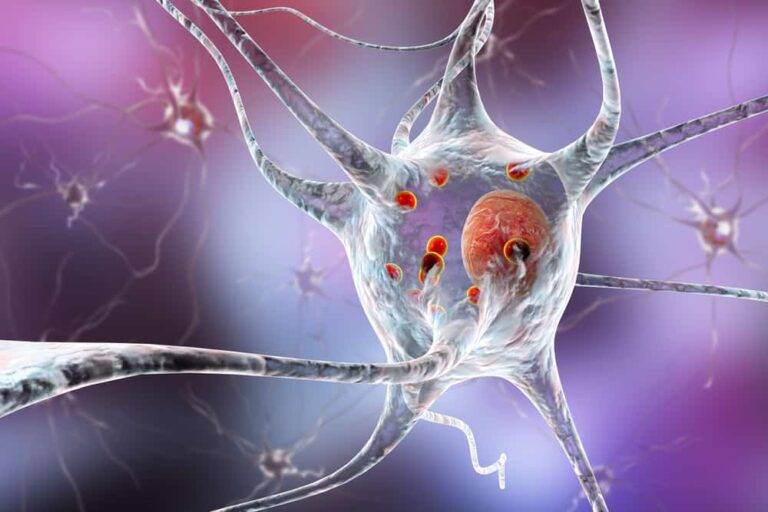パーキンソン病は遺伝するのか？専門家が解説する遺伝的要因、リスク、そして日本の最新情報