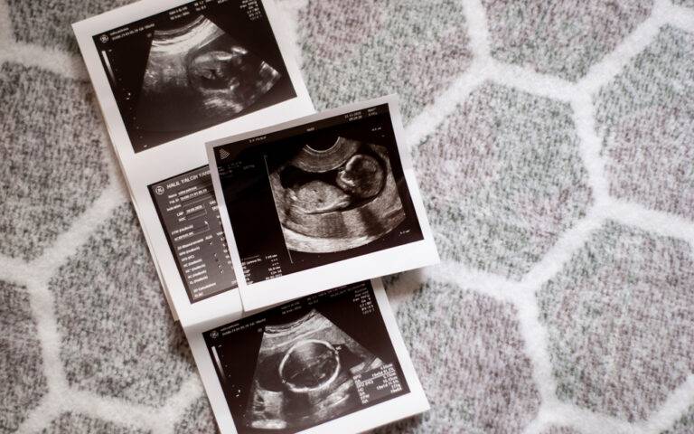 妊娠週数別の胎児の成長とママの体の変化のすべて：母子手帳と妊婦健診の完全ガイド