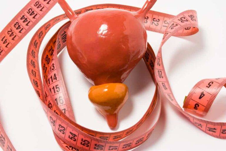 前立腺肥大症の完全ガイド：正常なサイズ、症状チェック(IPSS)、日本の最新治療法（ウロリフト、レジューム等）を徹底解説