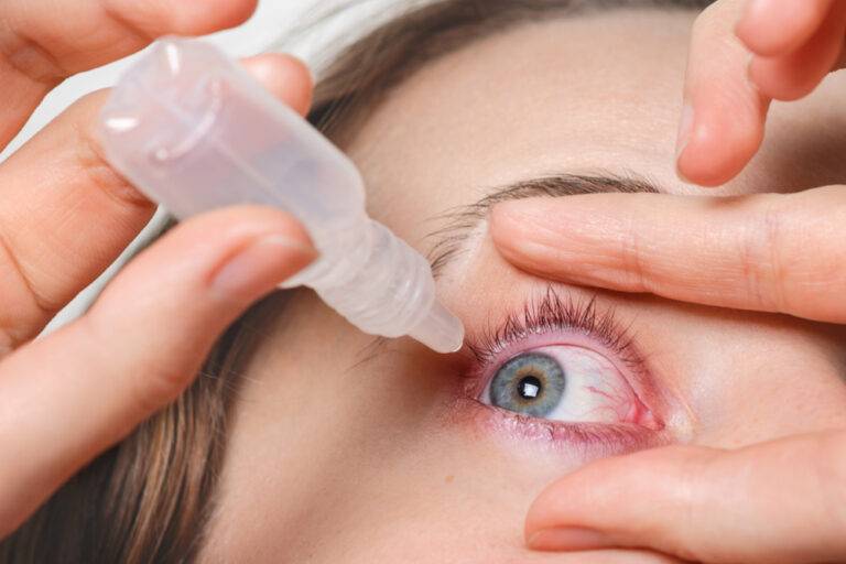 結膜炎の目薬完全ガイド｜原因別の正しい選び方から市販薬・処方薬の違いまで