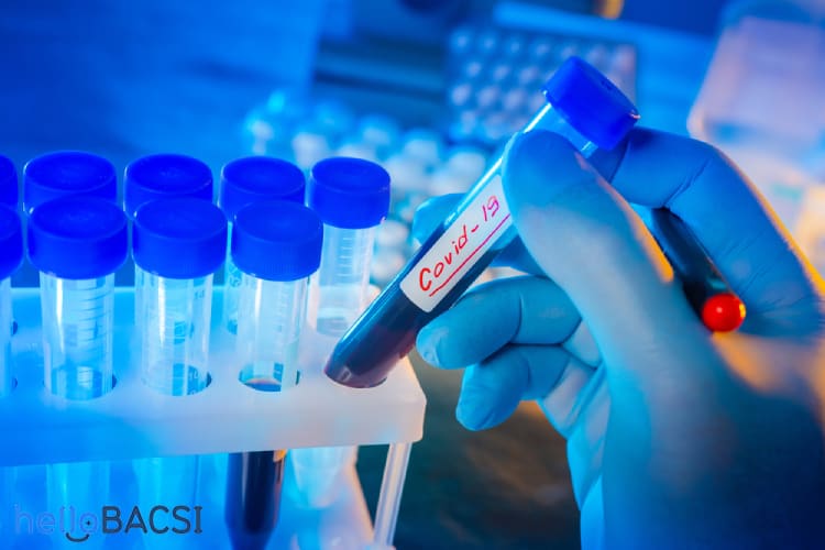 COVID-19とSARSの徹底比較：ウイルス学的特徴から臨床像、世界的影響まで専門家が最新知見を解説 (2025年版)