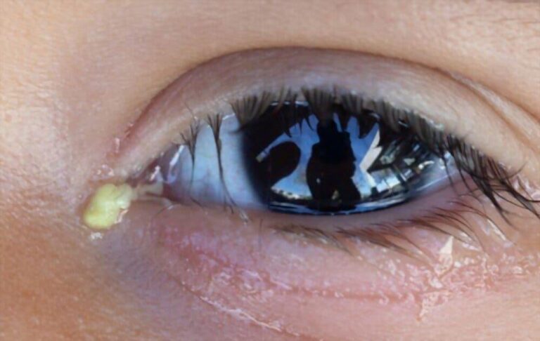 眼の病気 完全ガイド|症状・検査・治療・手術・予防 2 眼の病気 完全ガイド|症状・検査・治療・手術・予防