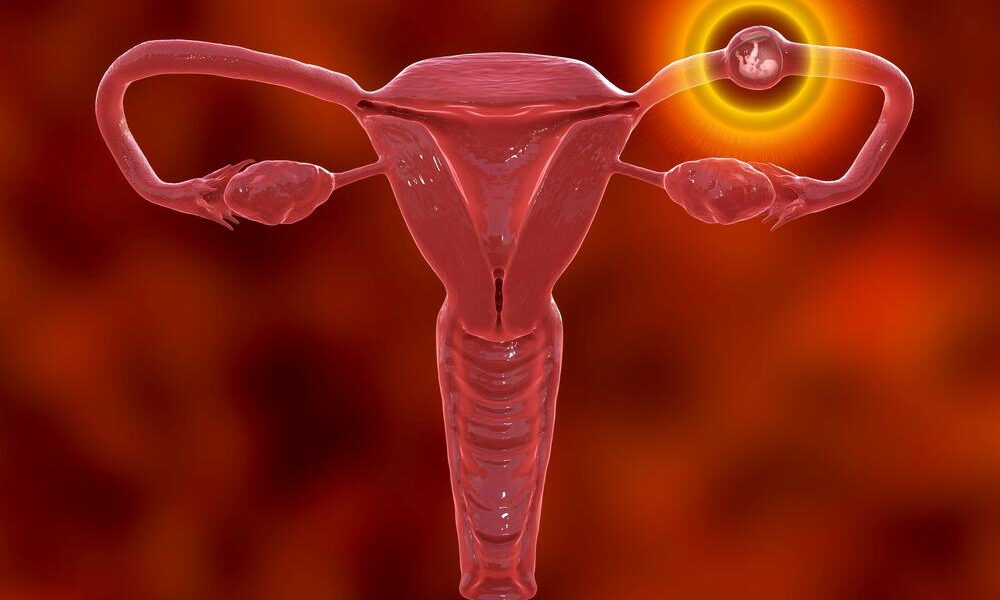 妊娠外妊娠の疑問解決：命は守れるのか？