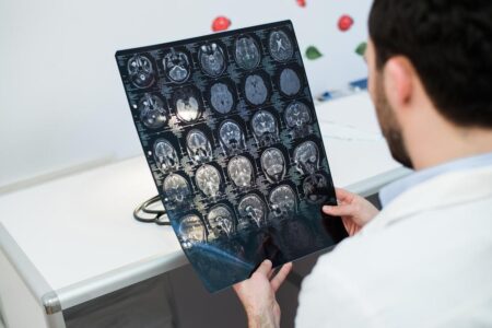 部分運動性てんかん：体に現れる発作のメカニズムとは？