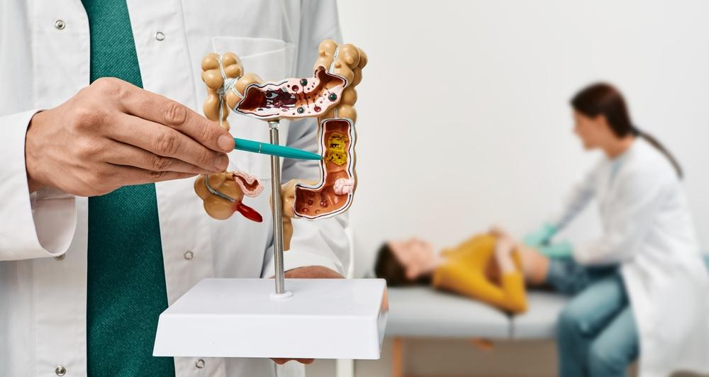 大腸がん検診の方法とは？| 健康を守る最新のチェックガイド