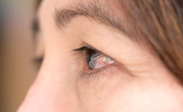 眼の病気 完全ガイド|症状・検査・治療・手術・予防 3 眼の病気 完全ガイド|症状・検査・治療・手術・予防