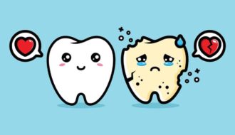親知らずは虫歯になるのか？その症状と対策法