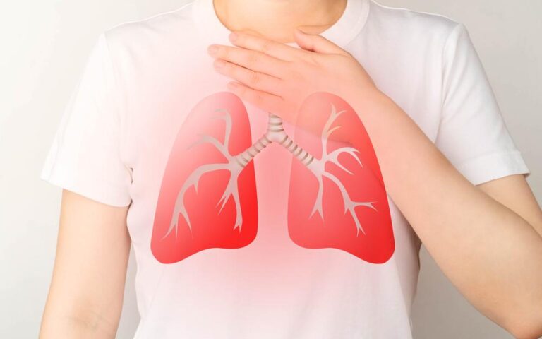 「肺水腫：その危険性と治療法」