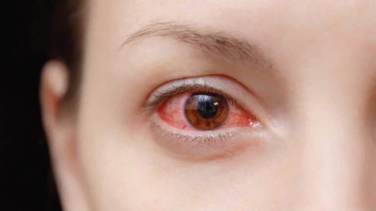 眼の病気 完全ガイド|症状・検査・治療・手術・予防 7 眼の病気 完全ガイド|症状・検査・治療・手術・予防