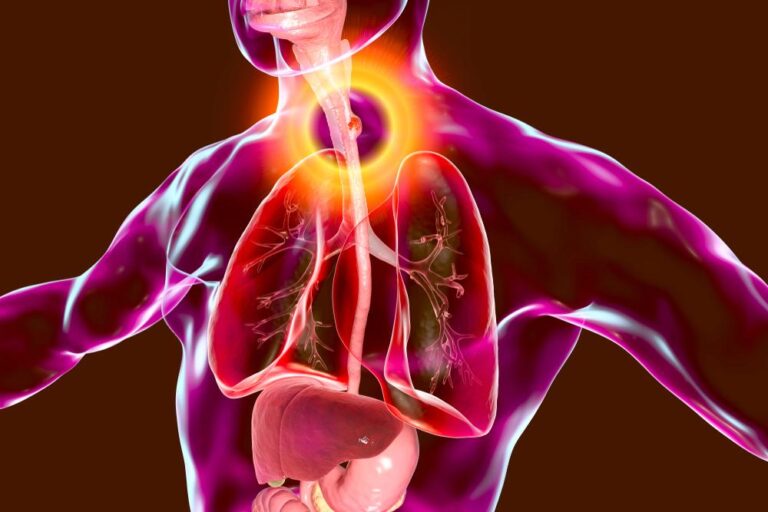 末期食道がんの真実：生存率、症状、そして希望の光となる最新治療法のすべて