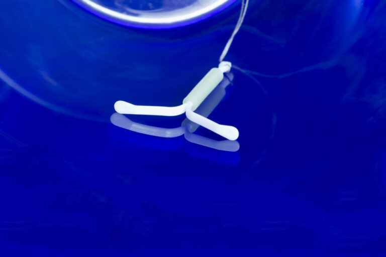 避妊リング（IUD）がずれるサインとは？確認法と危険な兆候、対処法まで徹底解説