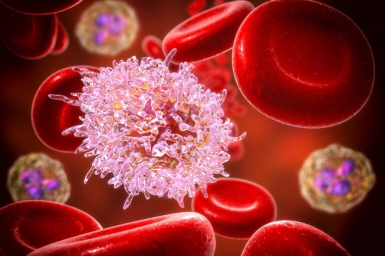 急性リンパ性白血病（ALL）のすべて：最新治療、生存率、世代別ガイド