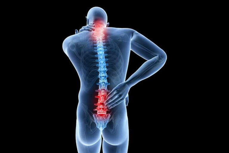 【専門医監修】若者の炎症性腰痛は強直性脊椎炎のサイン？症状・原因・治療法を徹底解説