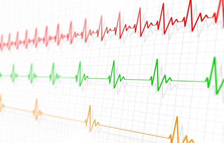 【徐脈（脈が遅い）】放置して大丈夫？危険なサインと原因・治療法・受診の目安
