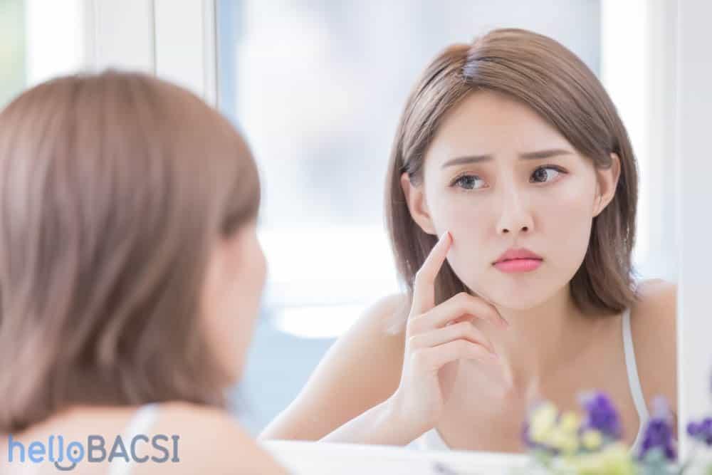 【皮膚科医監修】隠れニキビ（面皰）とは？原因から治し方、予防法まで徹底解説｜もう繰り返さないための完全ガイド