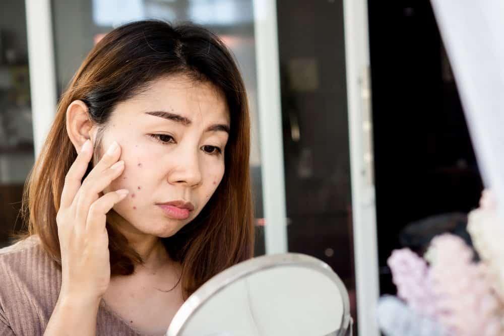 ビタミンC美容液：皮膚科医が解説するシミ・ニキビ跡への本当の効果と、日本での最適な製品の選び方