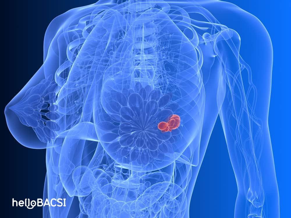 【科学的根拠に基づく】胸のしこり、これって大丈夫？乳腺症と線維腺腫を専門医が徹底解説（乳がんとの違い・検査・費用）