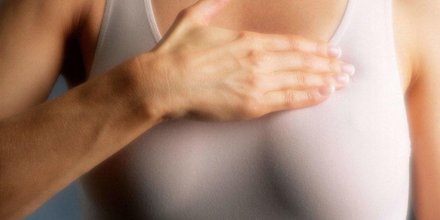 【科学的根拠に基づく】「乳腺管内乳頭腫」と診断された方へ：症状・原因・がんリスクから最新の治療選択肢まで専門医が徹底解説