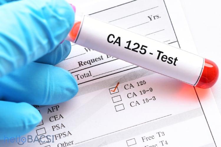 【科学的根拠に基づく】卵巣がん診断におけるCA-125検査の真実：早期発見のための包括的ガイド