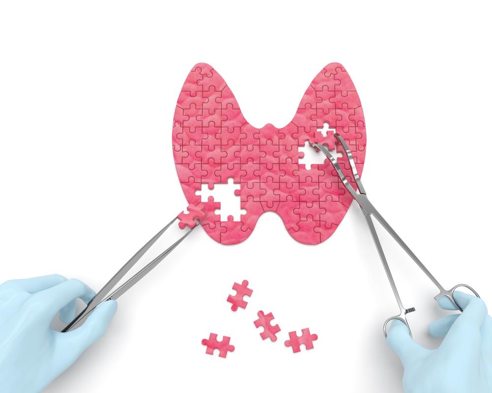 【科学的根拠に基づく】甲状腺部分切除術の完全ガイド：手術の必要性、手順、費用、術後の生活のすべて