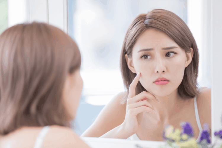 頬の隠れニキビを撃退：皮膚科医が教える原因と治療法の全知識【2024年最新ガイドライン準拠】