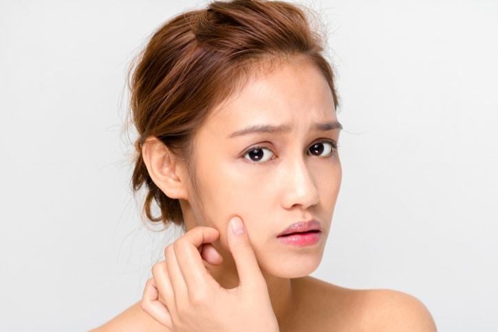 【科学的根拠に基づく】傷跡（瘢痕）の種類と治療法を完全網羅｜ケロイド・ニキビ跡を消すための皮膚科・形成外科的アプローチと保険適用