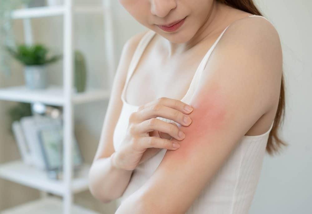 大人の汗疹（あせも）：原因・症状から治療・市販薬・完全予防ガイド