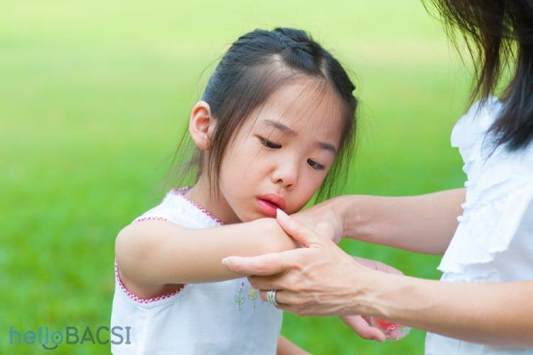 【医師監修】小児の皮膚感染症：原因、症状から最新治療、効果的な予防策まで徹底解説