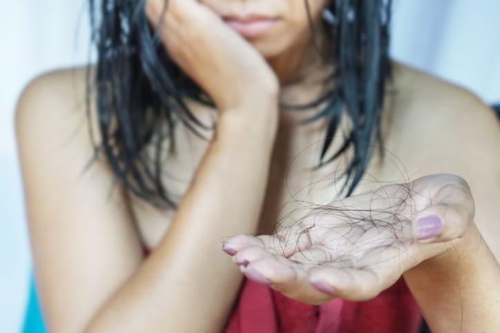 【医師監修】10代・思春期の薄毛・抜け毛（若年性脱毛症）の原因と対策｜治療は可能？病院へ行くべき？