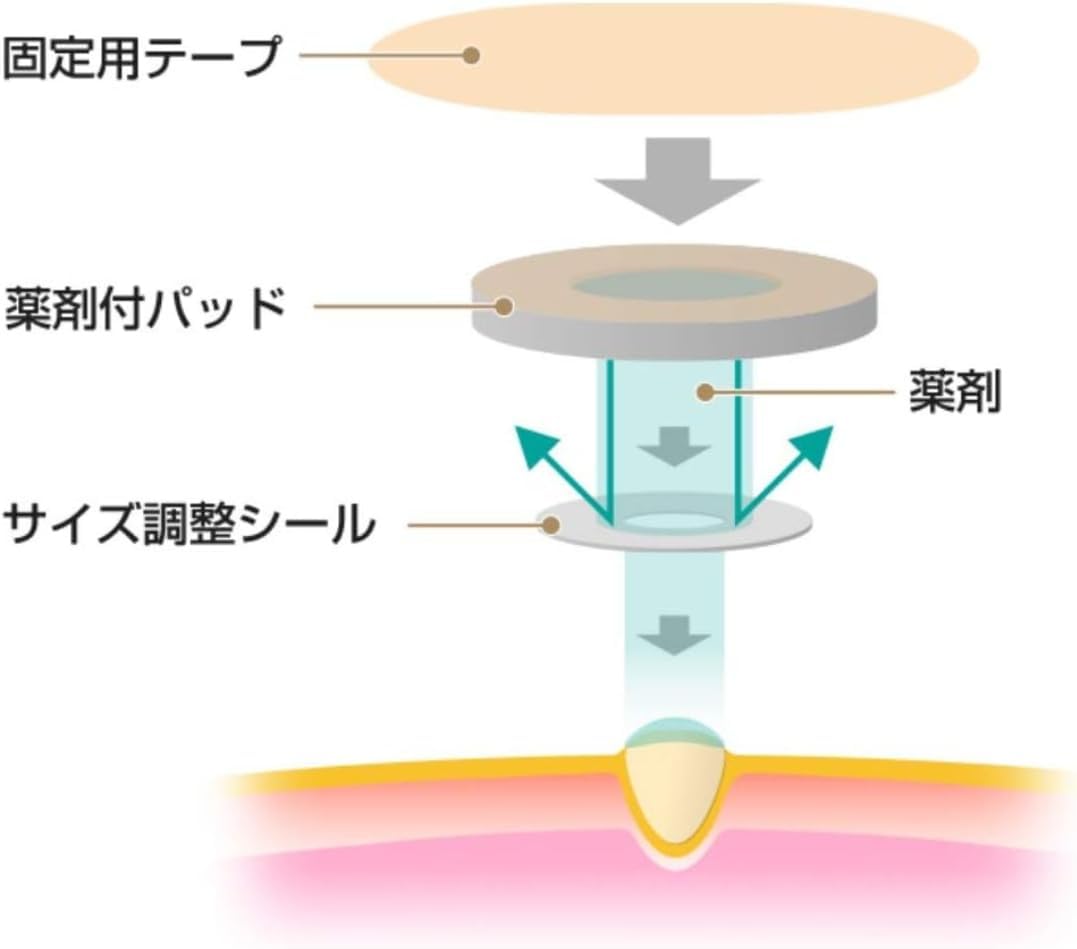 Speel Plaster 画像