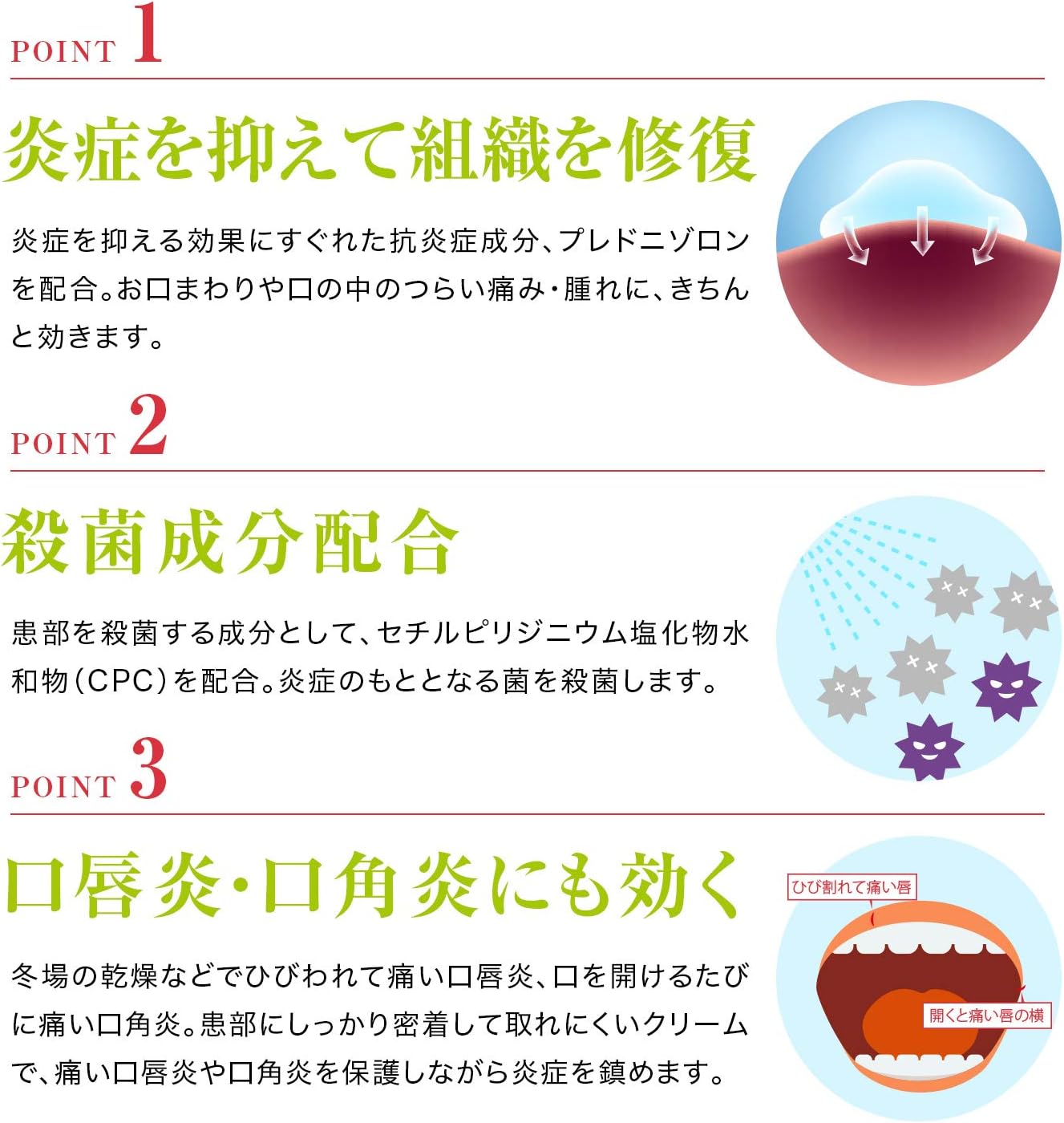 【指定第2類医薬品】デンタルピルクリーム 5g（外観）