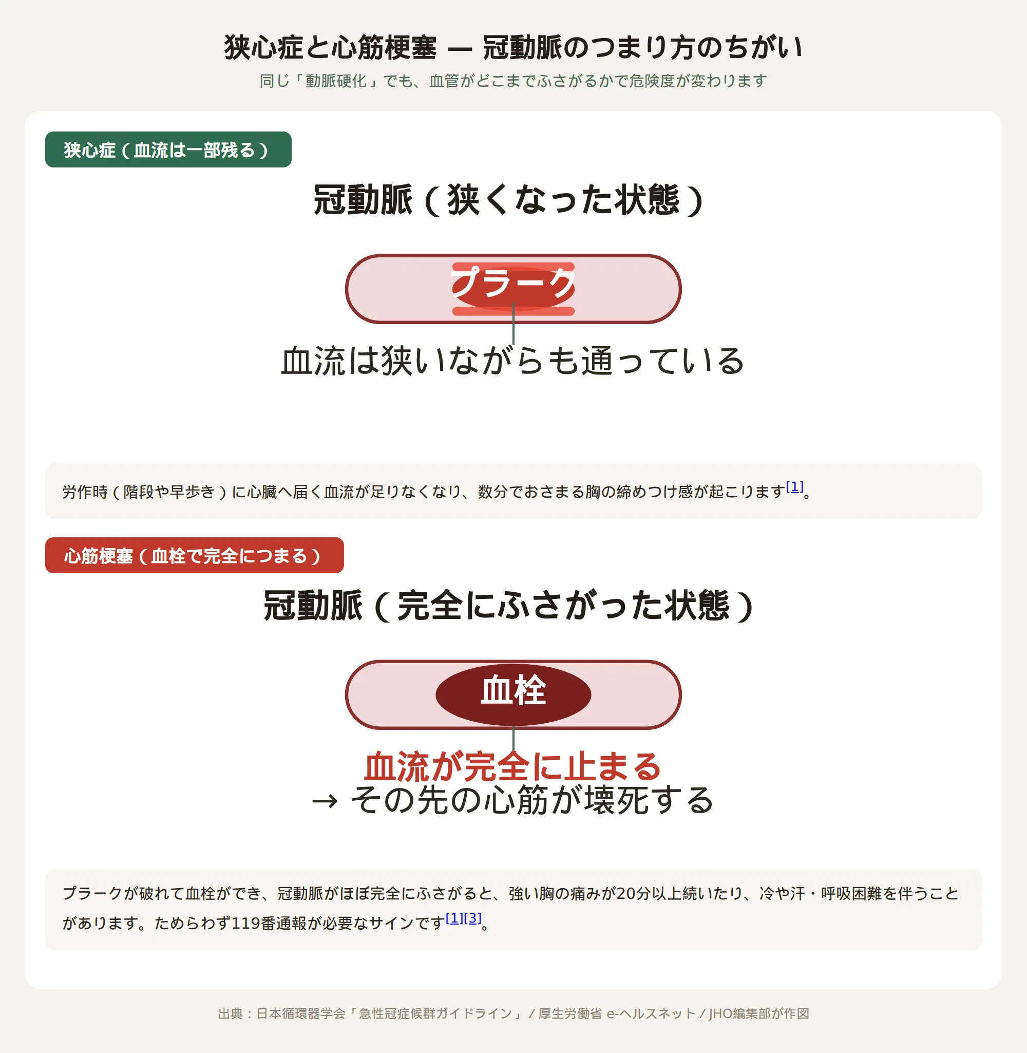 狭心症と心筋梗塞の違いを示す冠動脈の模式図