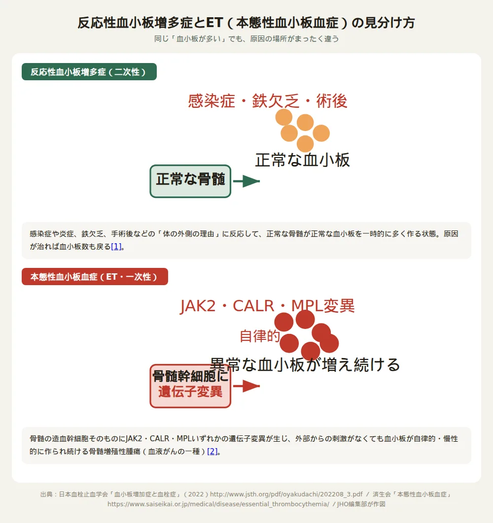 反応性血小板増多症とET（本態性血小板血症）の見分け方の図解