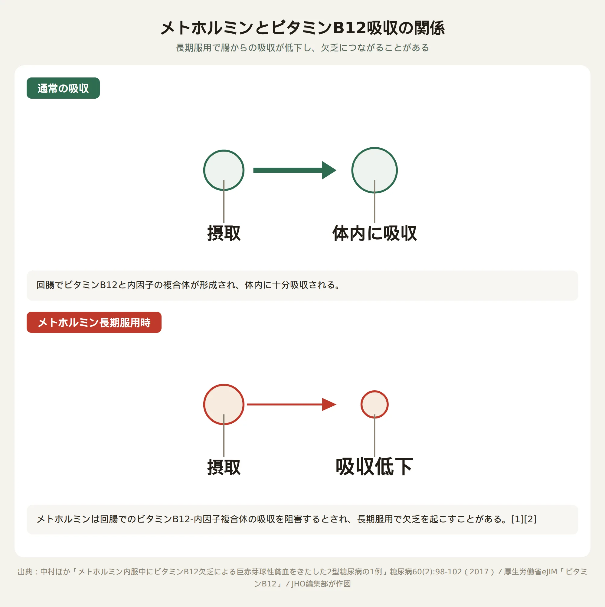 メトホルミンとビタミンB12吸収の関係を示す図。通常は腸で十分に吸収されるが、メトホルミンの長期服用では吸収が低下することを示す