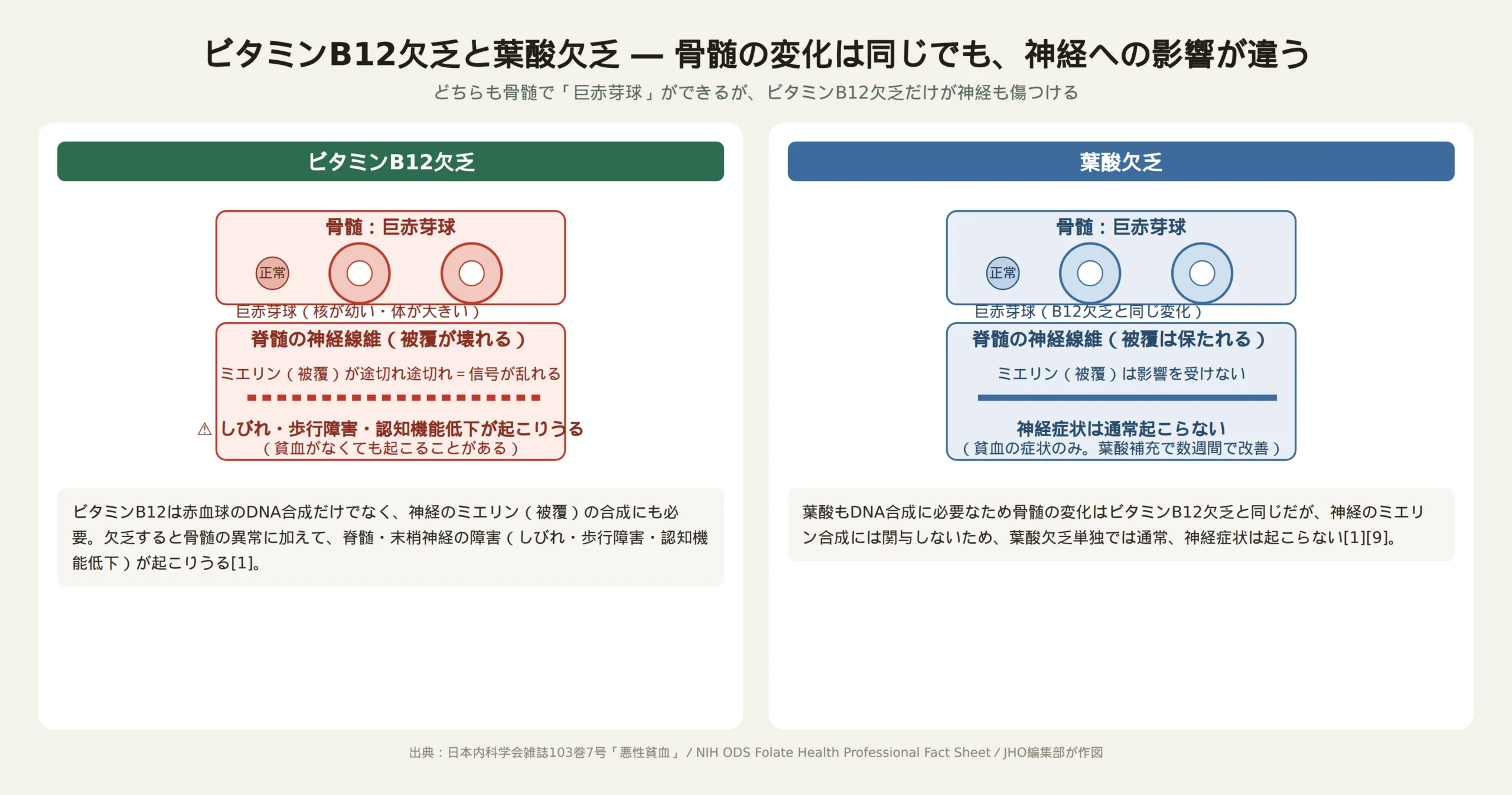 ビタミンB12欠乏と葉酸欠乏、それぞれで血液細胞に何が起こるかを示した解説イラスト