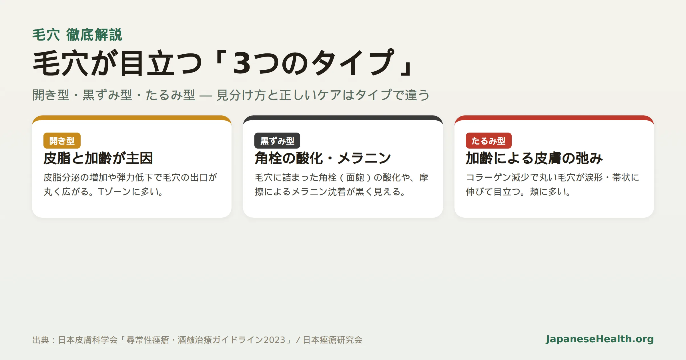 毛穴が目立つ3つのタイプ（開き型・黒ずみ型・たるみ型）の見分け方とケアの違いを示す図解