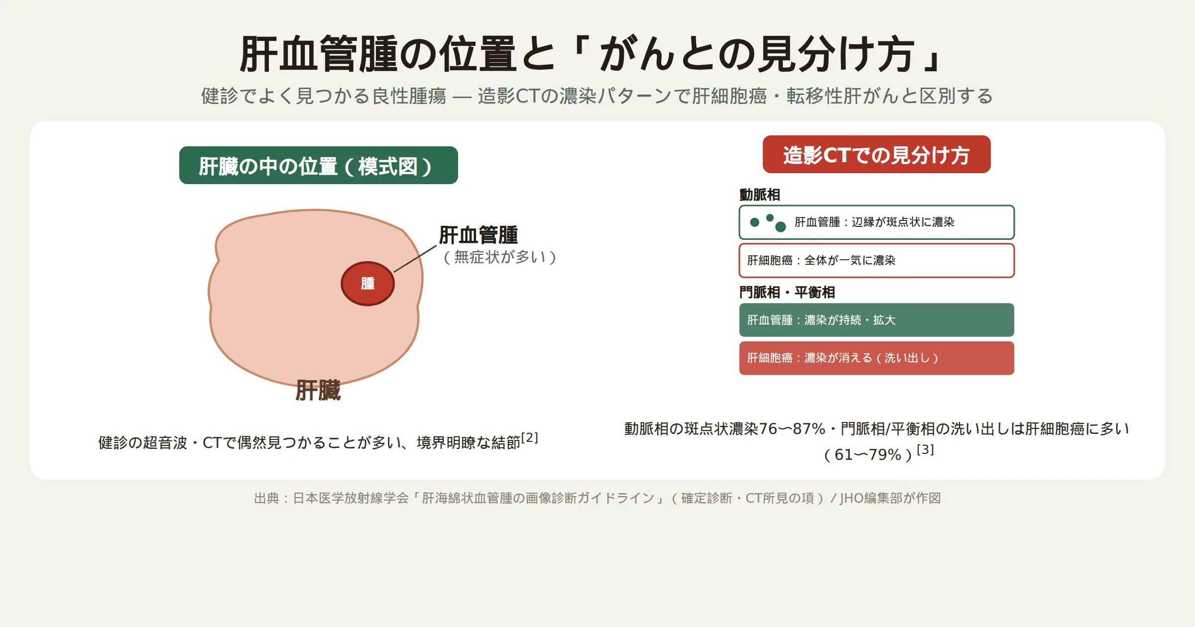 肝血管腫の肝臓内での位置の模式図と、造影CTの動脈相・門脈相での肝血管腫と肝細胞癌の濃染パターンの違いを比較した図