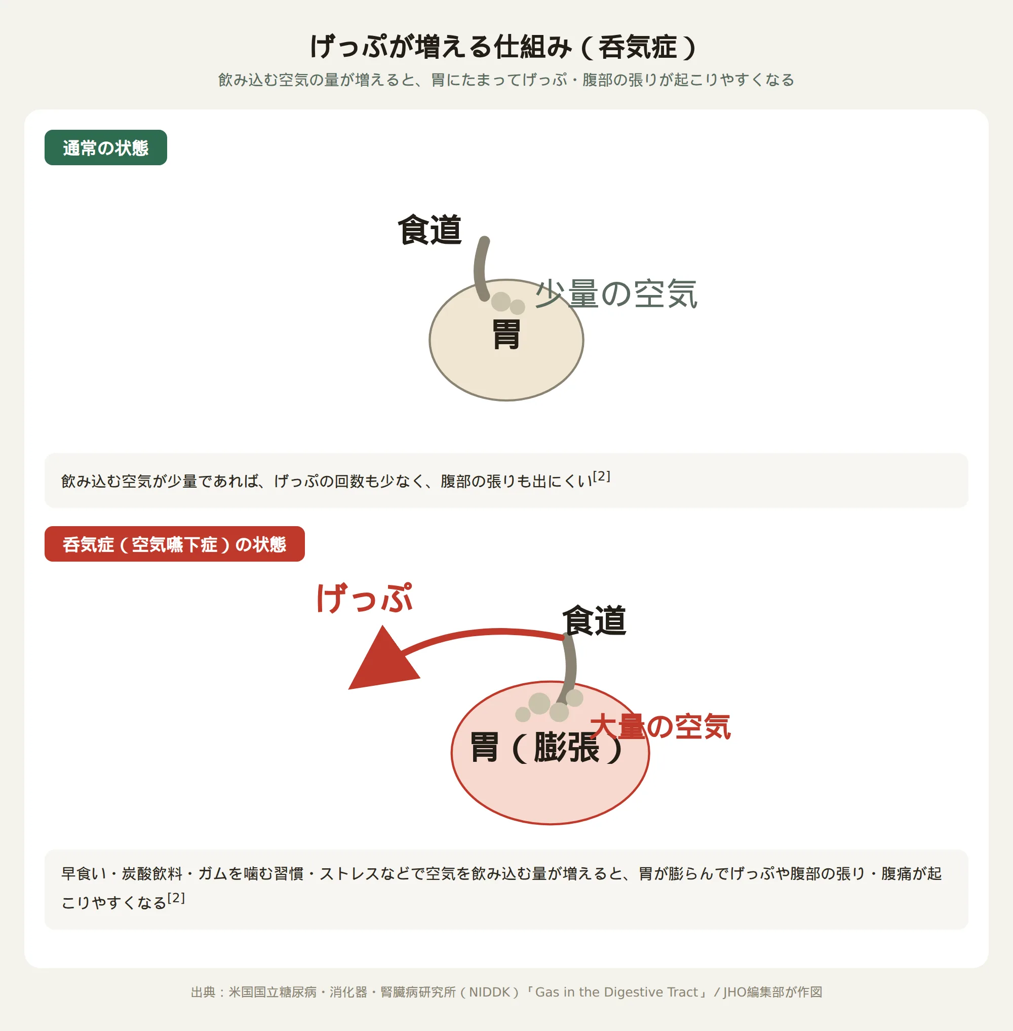 げっぷが増える仕組み（呑気症）を示す図。通常は少量の空気を飲み込むが、早食いや炭酸飲料で空気を飲み込む量が増えると胃が膨らみげっぷと腹痛が起こりやすくなる