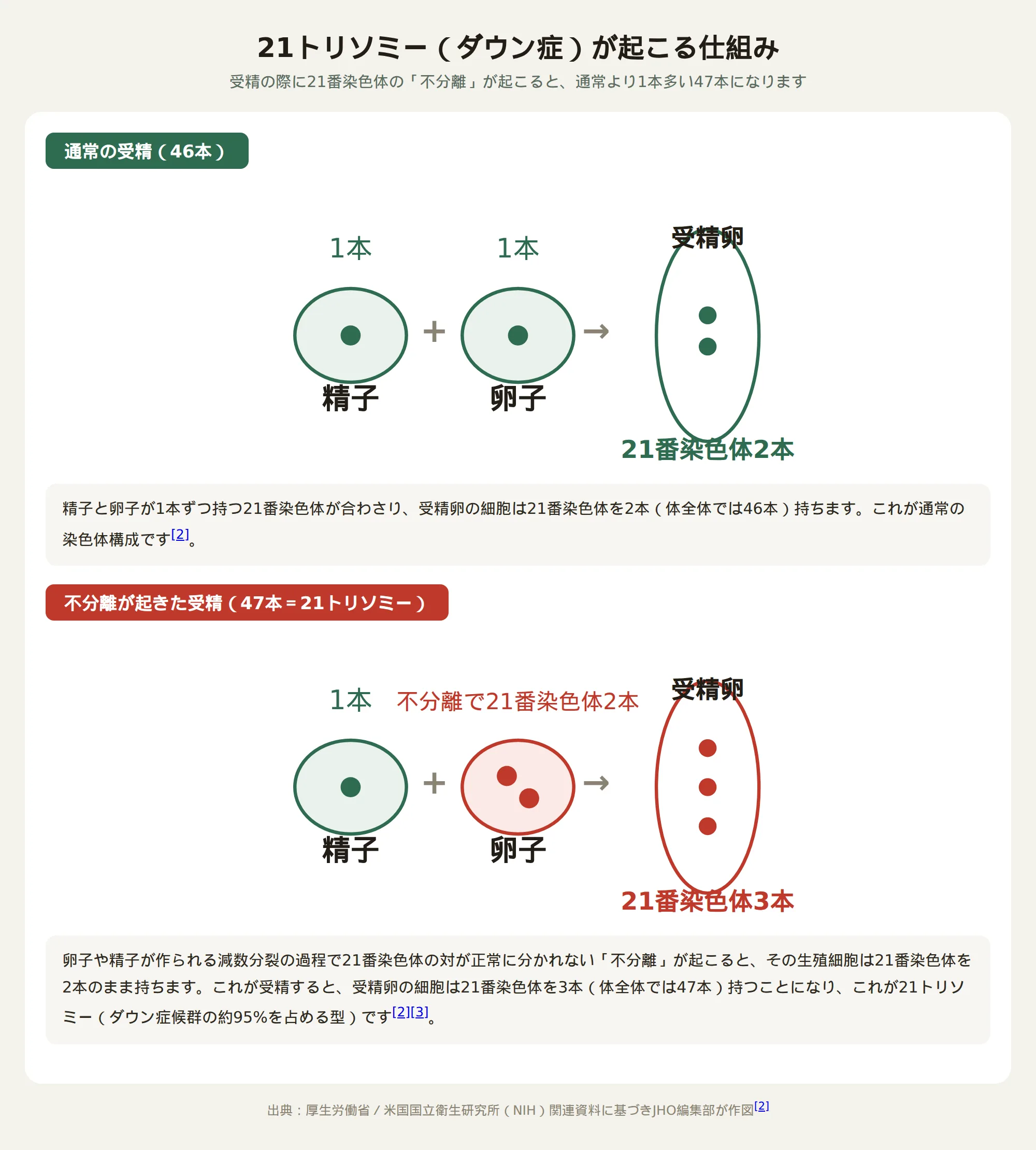 21トリソミー（ダウン症）が起こる仕組みを示す図（通常の受精と不分離が起きた受精の違い）