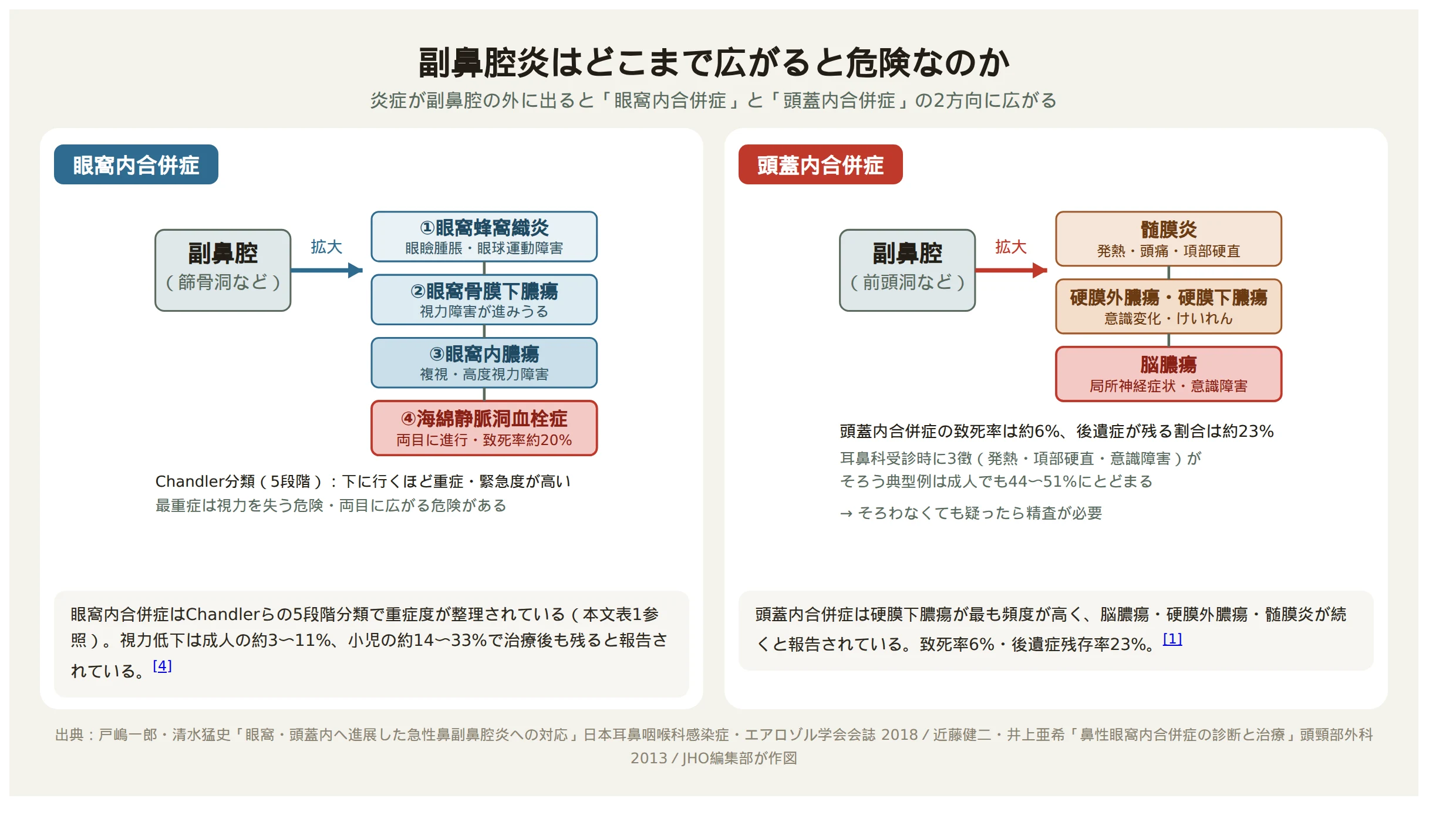 副鼻腔炎の炎症が眼窩内合併症と頭蓋内合併症の2方向に広がる仕組みを示す図