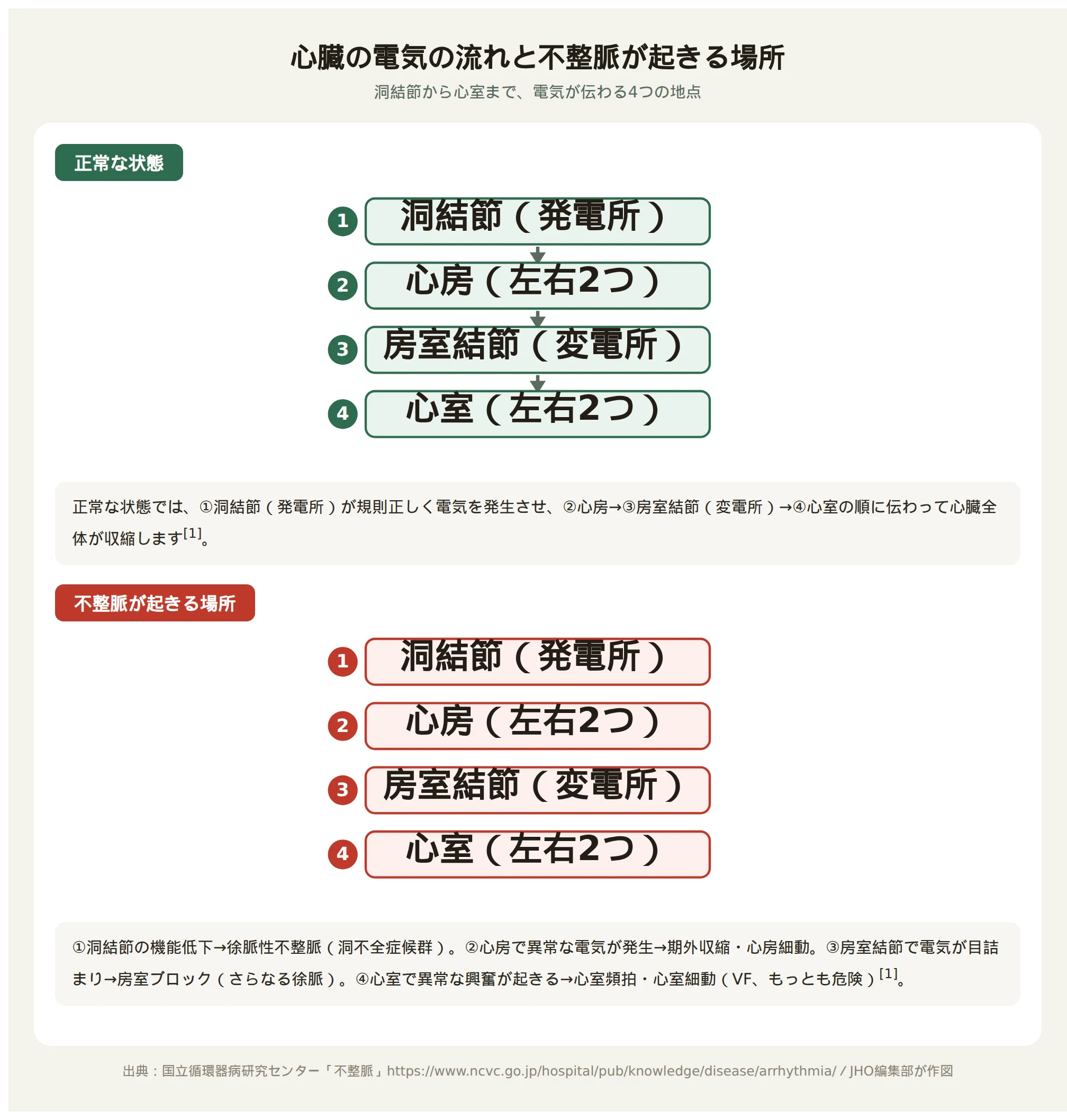 正常な心臓の電気の通り道と不整脈が起きる仕組みを比べた図。上段は洞結節で発生した電気が心房・房室結節・心室の順に伝わる正常な伝導路、下段は電気の発生源や通り道が乱れて動悸・失神が起こる状態を示す。