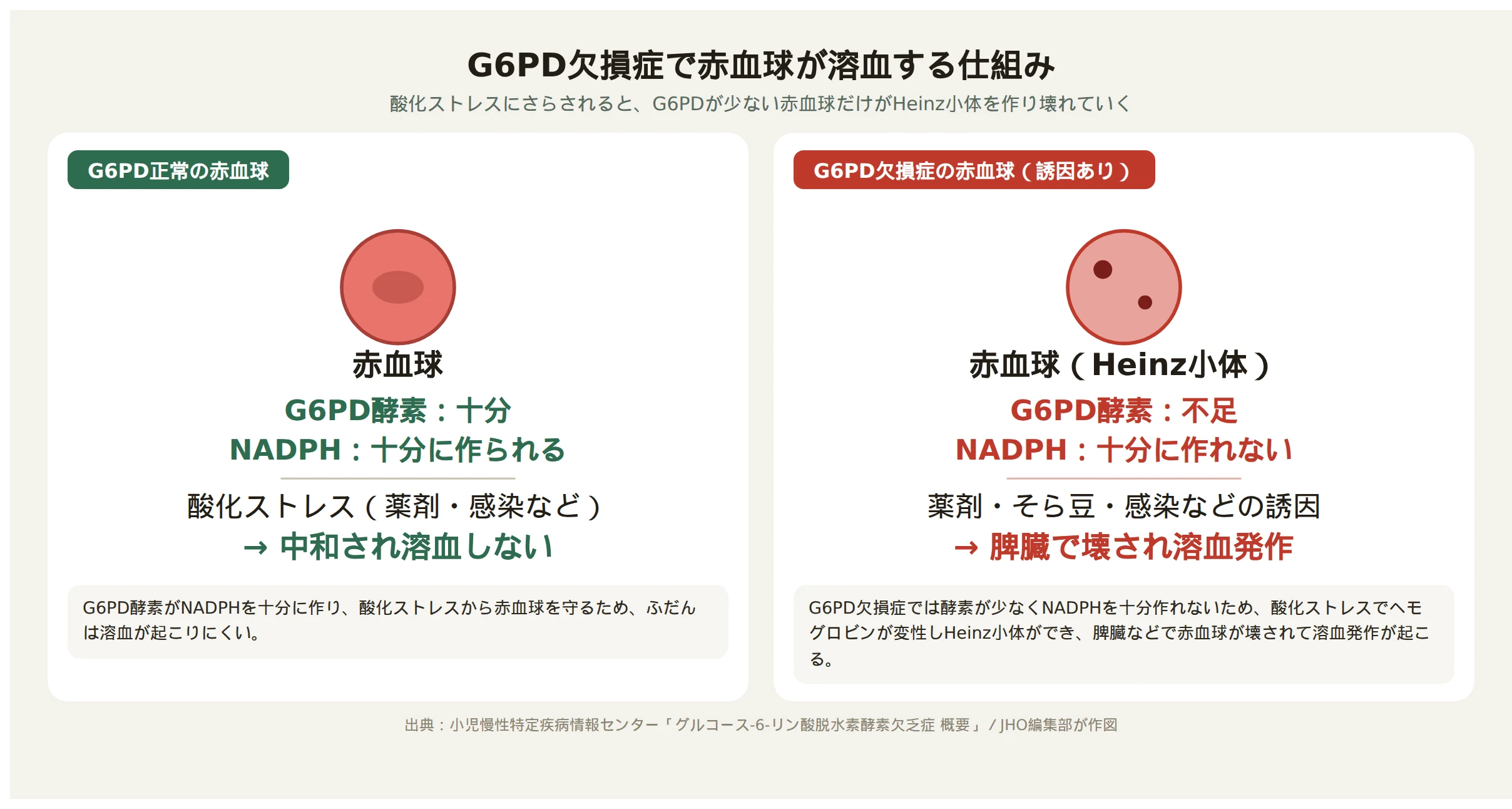 G6PD欠損症で酸化ストレスにより赤血球が溶血する仕組みの図解